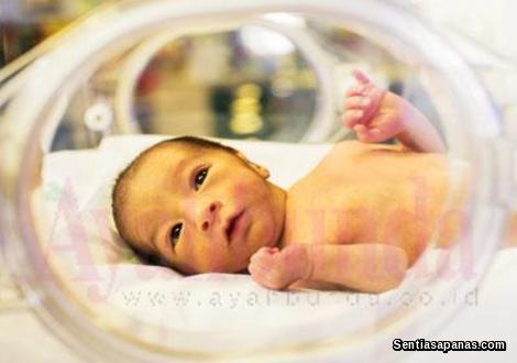 Kenapa Bayi Menghidap Penyakit Kuning Selepas Dilahirkan 