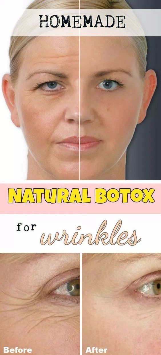 Facial Mask With Botox Effect. Cheap and Easy to Make HEALTHYLIFE