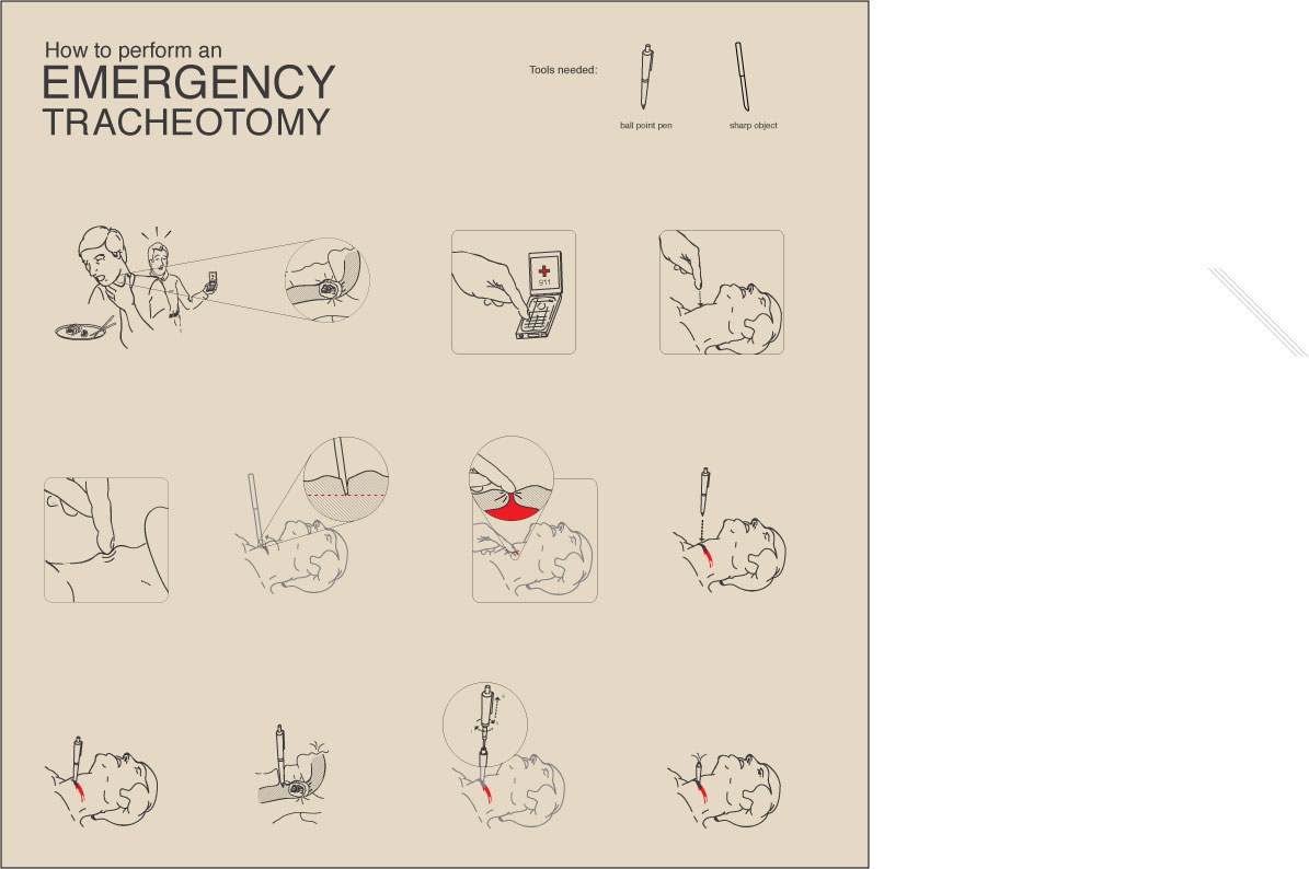 Ballpoint Pen Parker Pic Ballpointpen Tracheotomy