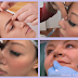 Kombinasi Facelifting Yang Menjadi The Best Choice