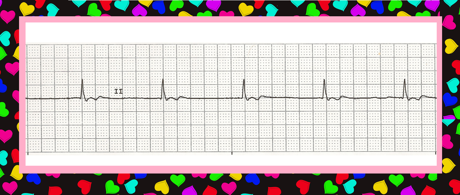 Practice EKG Strips (Valentine's Day)