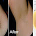 Removing Underarm Hairs In Just 2 Minutes