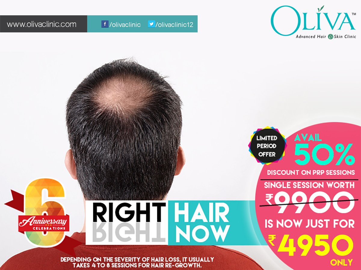 Oliva Clinic- Best Skin and Hair Clinic in Hyderabad and Bangalore: Flat  50% off on PRP Hair Loss Treatment in Hyderabad and Bangalore | PRP Hair  Fall Treatment Offers