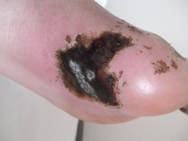 Rheumatologe: Skin Lesions of Unknown Etiology