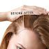 5 Secrets to Increase Hair Growth