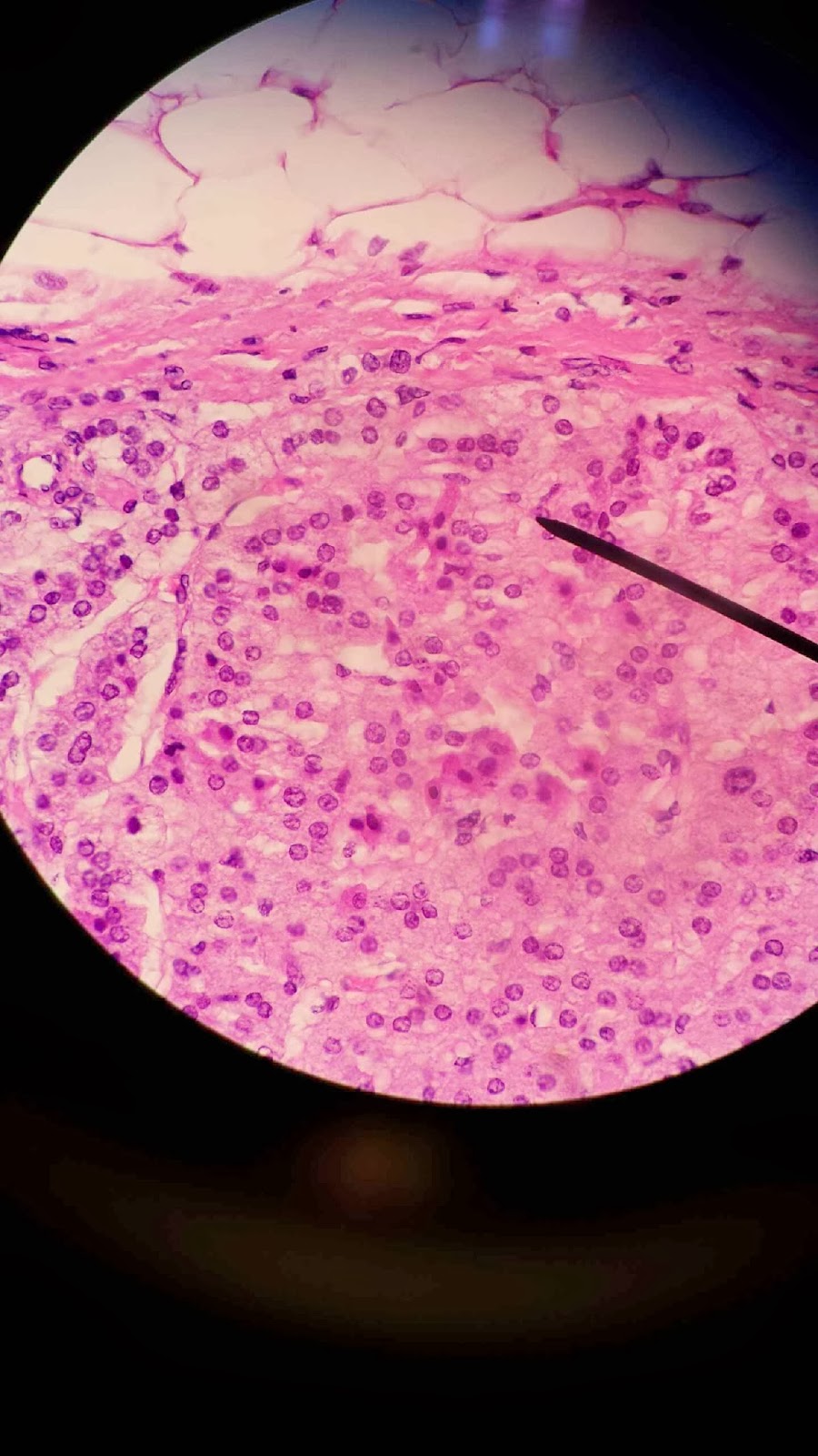 Histology: Adrenal Gland