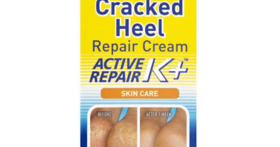 Best creams available for cracked heels