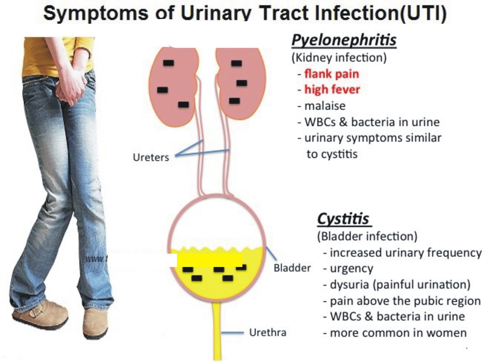 simultaneous sinus urinary infection