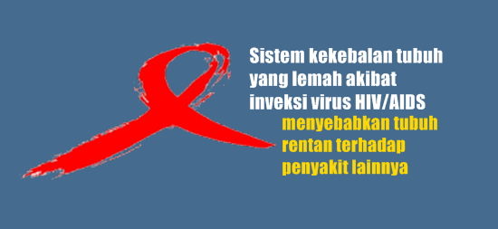 Cara Penanganan HIV /AIDS Dan Harapan Hidup Bagi Penderitanya
