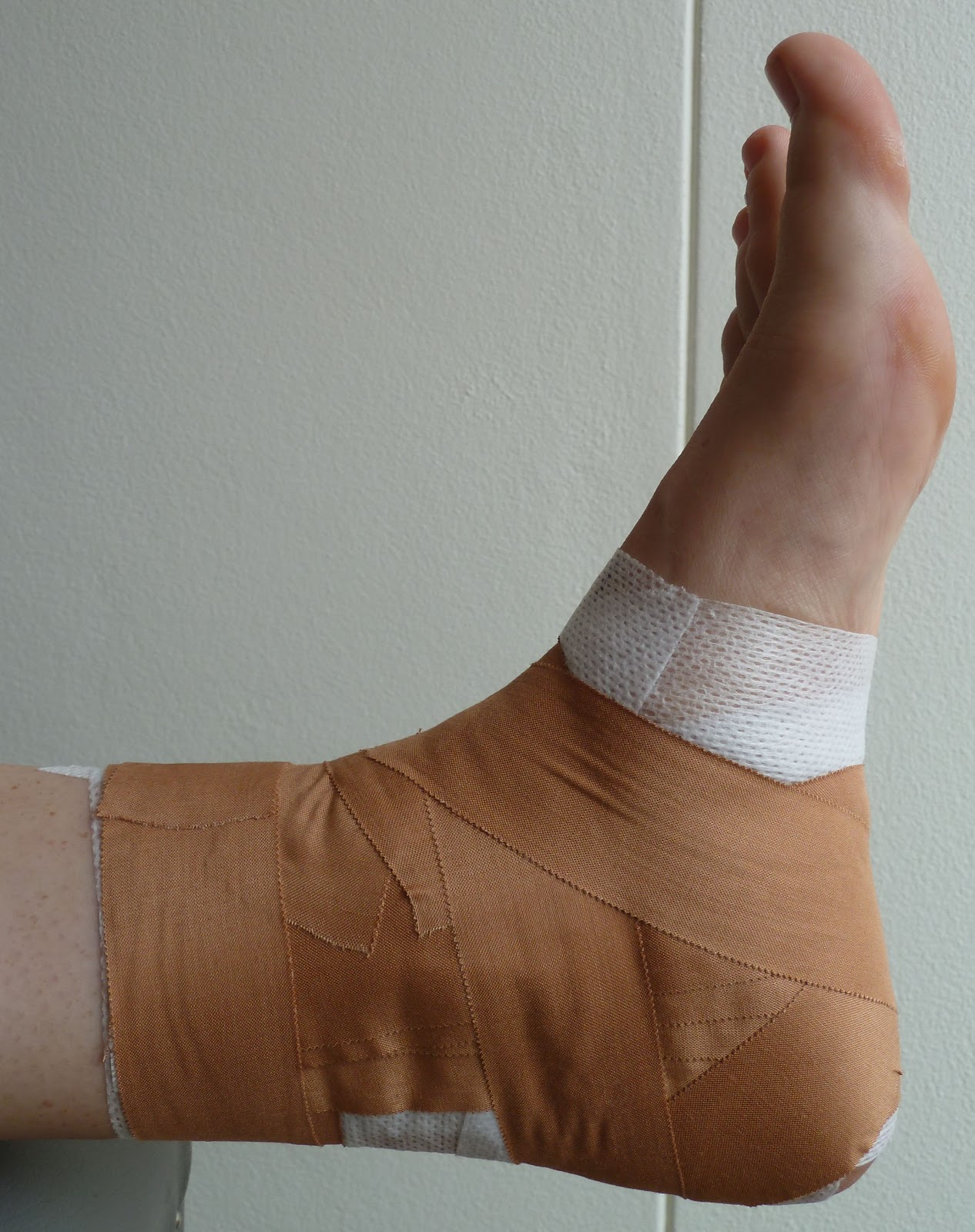 THE SHARP ARROW Netball To brace or to tape ankles?