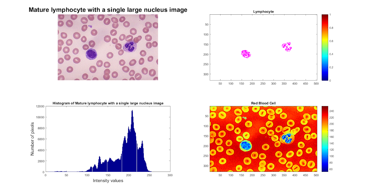 Biomedical Signal and Image Processing projects using Matlab and ...