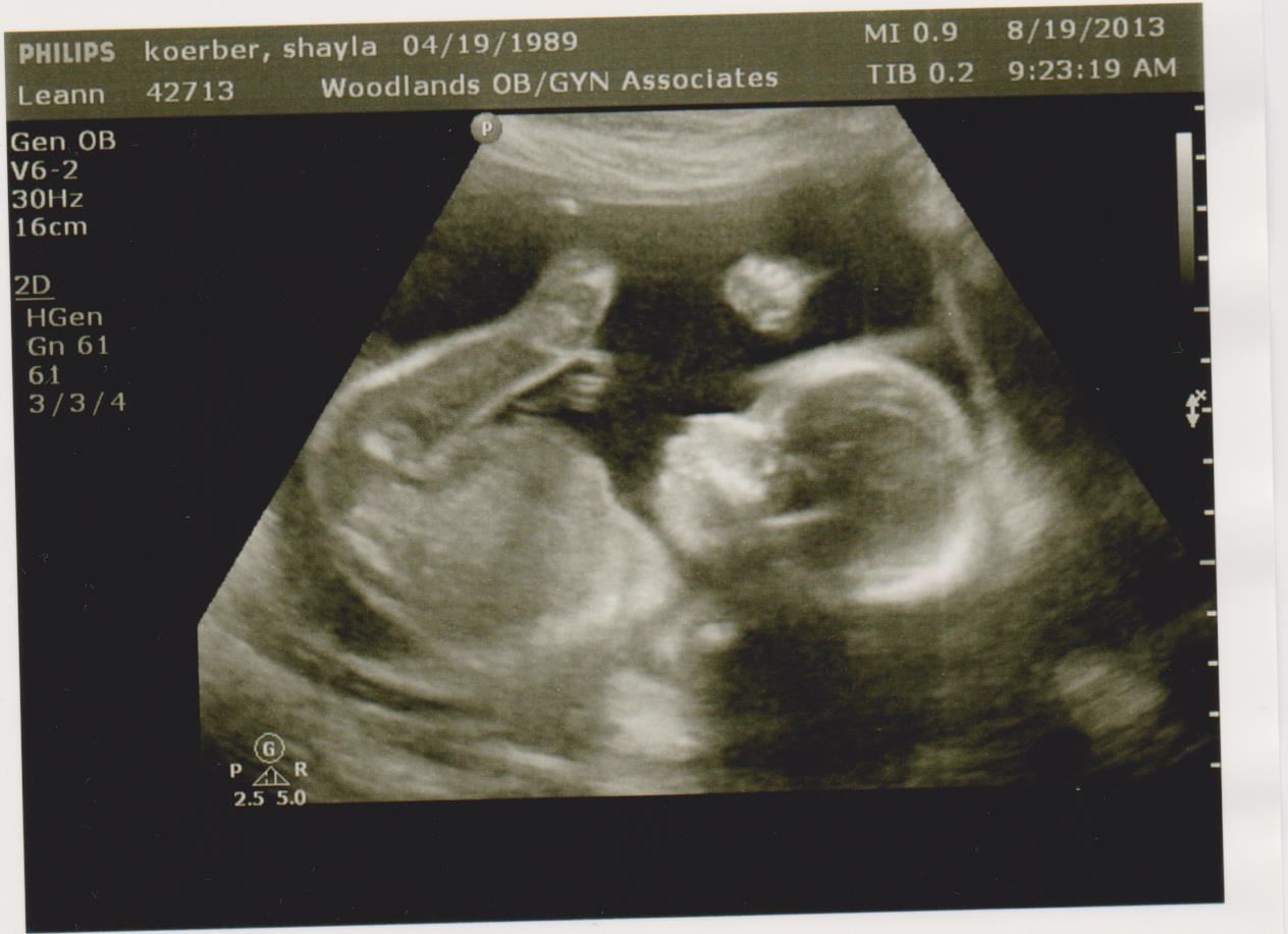 20 week ultrasound 4d 20 week ultrasound 4d