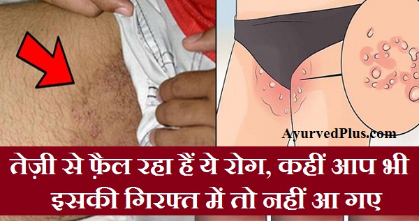 तेज़ी से फ़ैल रहा हैं ये रोग, कहीं आप भी इसकी गिरफ्त में तो नहीं आ गए