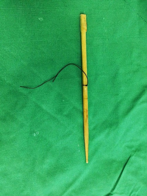 5 Gambar Penyepit Makanan Tertusuk Mulut Tembus Ke Otak 5 Gambar Penyepit Makanan Tertusuk Mulut Tembus Ke Otak