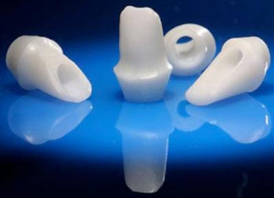 Các loại răng sứ thông dụng