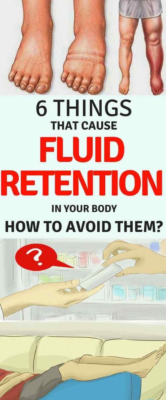 6 Things That Cause Fluid Retention In Your Body And How To Avoid Them
