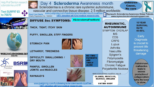 Raynauds Scleroderma Global Patients: DAY 4: Scleroderma ...