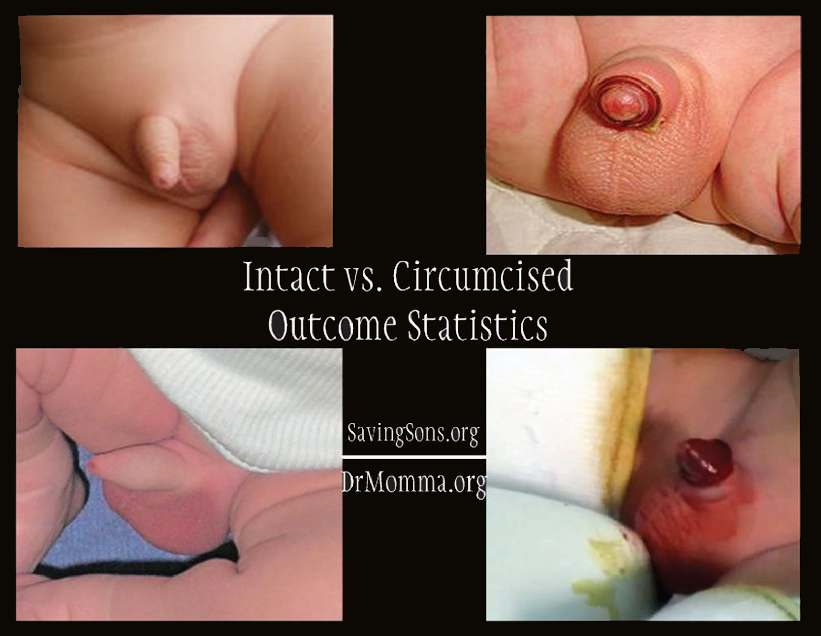 Anti circumcision celebrities