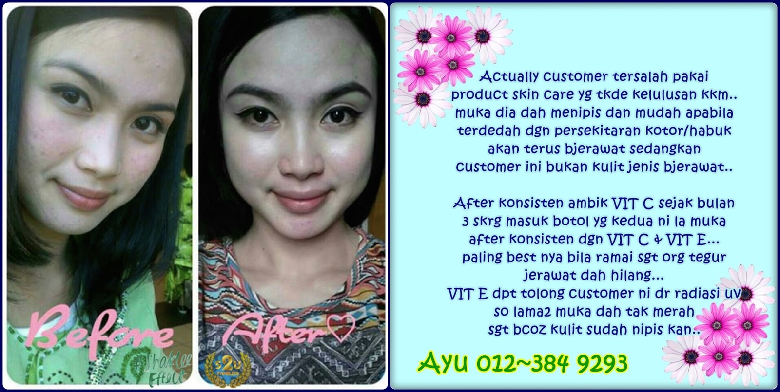 testimonial kulit cantik ayuhsihat.blogspot.com
