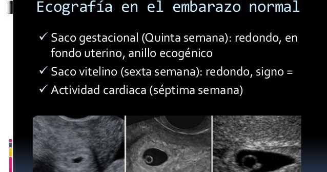 Muy abundante mensual y el dolor en los riñones