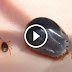 A Farmer Mysteriously Died a After Biten By A Tickbite, What The Doctors Found Out Was Horrifying!