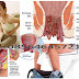 CIRI2 PENYAKIT AMBEYEN thumbnail