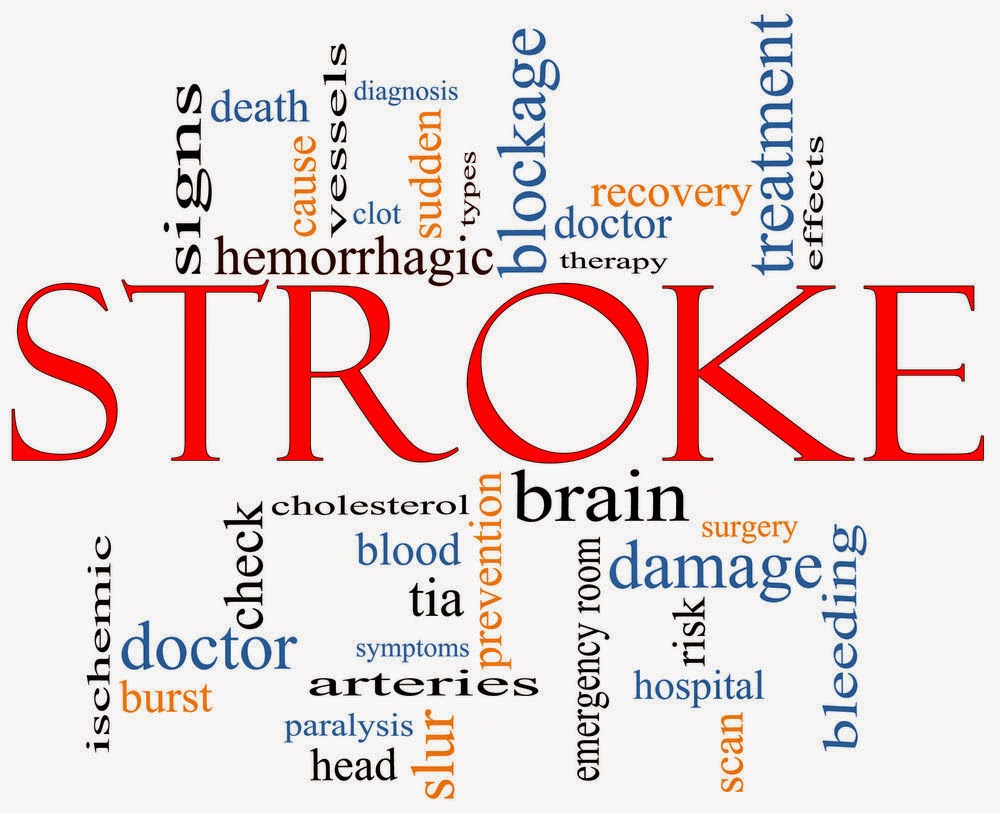 serangan stroke