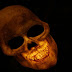 What is the cause of one-third of human deaths in recent years?