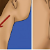 7 Best Home Remedies to Get Rid of Lump On Your Neck, Back or Behind Your Ear Naturally