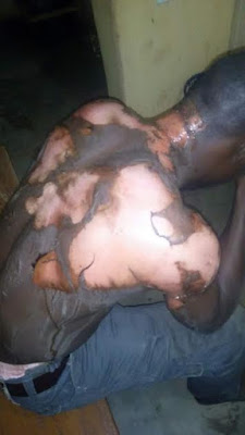 0 Photos: Angry wife pour boiling water on husband in Plateau State for marrying second wife