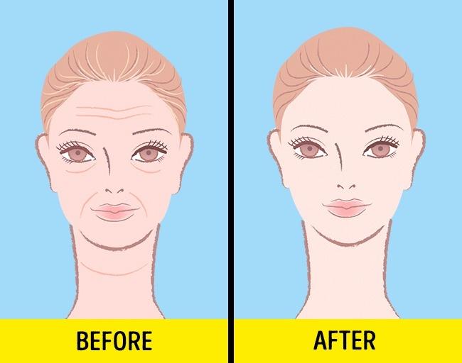 Nhiều tác dụng khác của nước dừa, ngoài việc giảm cân hiệu quả Nhiều tác dụng khác của nước dừa, ngoài việc giảm cân hiệu quả