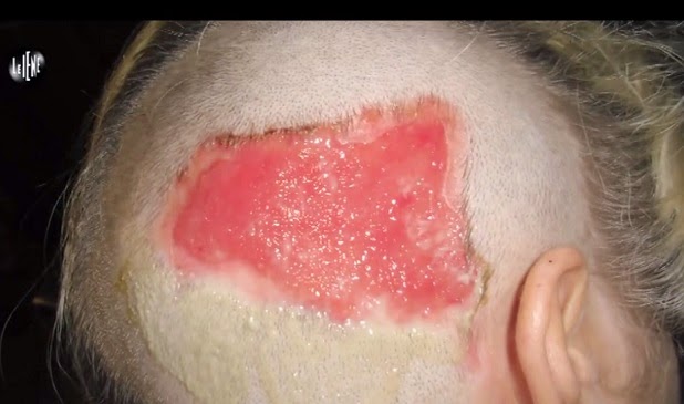 La maschera per capelli che tolgono lavando la vernice