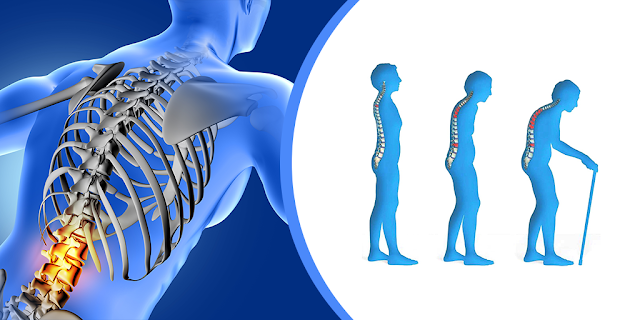 Sebelum Ditemukan Alat Pemindai Tulang X-Ray, Al Quran Sudah Menjelaskan Tentang Osteoporosis