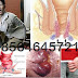 Jangan Remehkan Wasir Dalam Yang Prolaps thumbnail