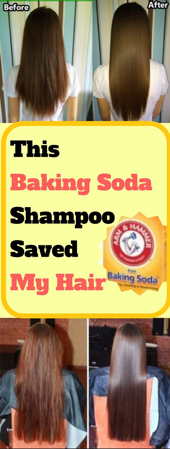 This Baking Soda Shampoo Saved My Hair HEALTH RECIPES