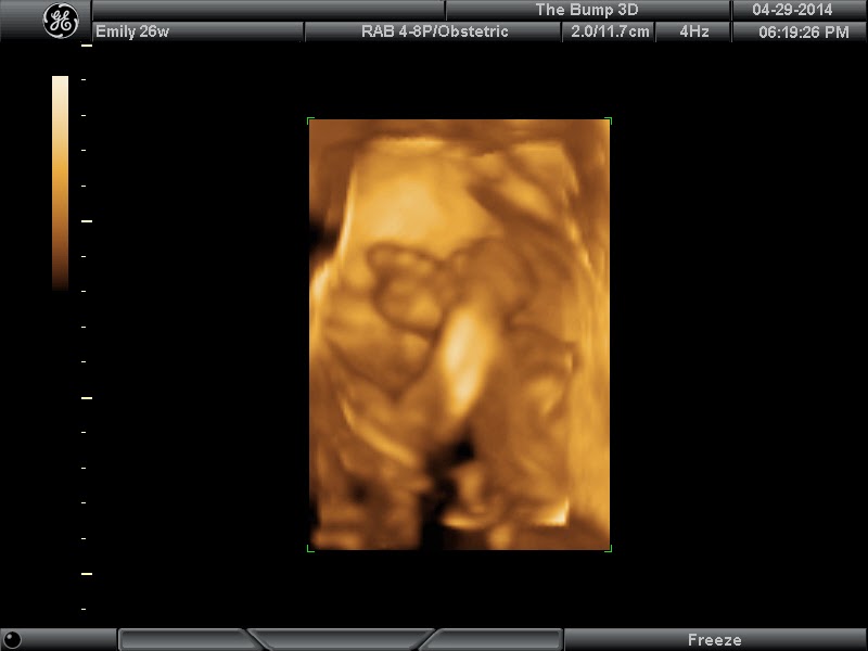 Leo’s 4D Ultrasound!
