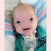 ‘Miracle baby’ born without a nose dies at age two