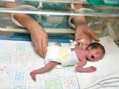 Gaya Terbaru 33+ Gambar Bayi Prematur