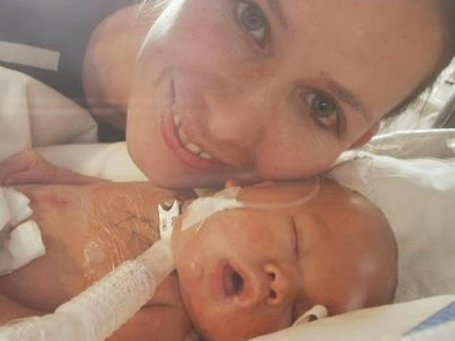 extraordinarios casos de supervivencia de bebes recién nacidos