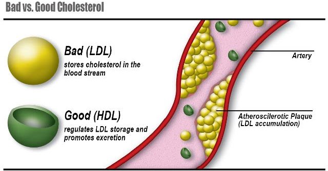 Como subir el colesterol hdl