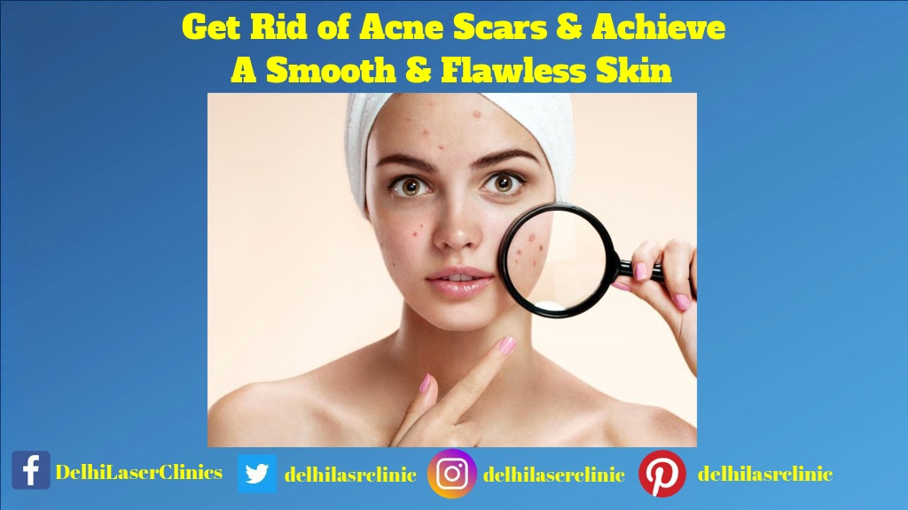 Delhi Laser Clinic, Dwarka New Delhi Get rid of acne scars and achieve