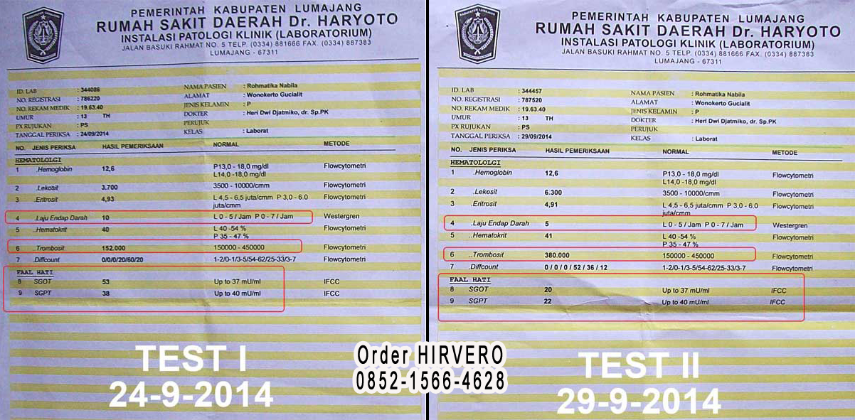 Bukti lap setelah menggunakan hirvero testimoni hirvero, cara minum hirvero, aturan minum hirvero, khasiat hirvero, jual hirvero, reaksi setelah minum hirvero, harga member hirvero, zebakton, Cairan Obat Dalam, Hirvero, Obat Herbal, Obat Tetes Herbal,