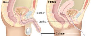 Penis Sakit Dan Keluar Nanah Saat Kencing Penis Sakit Dan Keluar Nanah Saat Kencing
