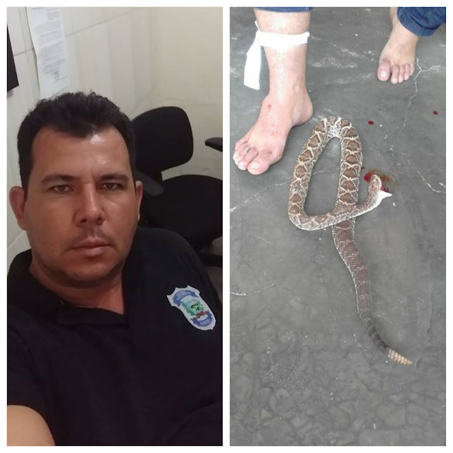 Na Paraíba, Vereador é picado por cobra cascavel e mata animal com uma "dentada" 