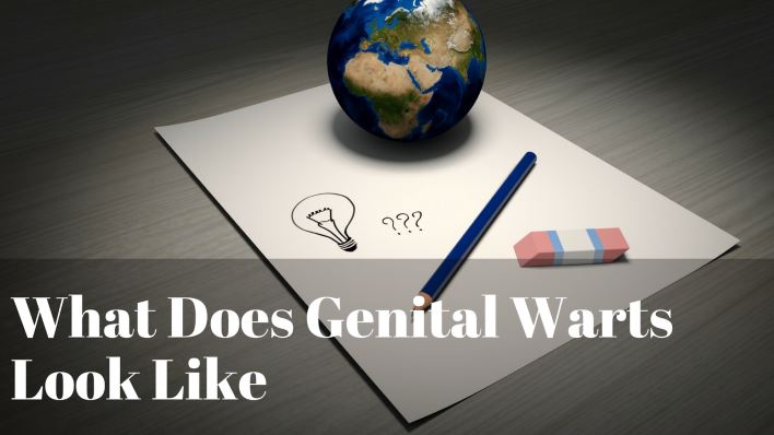 What Does Genital Warts Look Like What Does Genital Warts Look Like