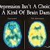 Depression Isn’t A Choice, It’s A Kind Of Brain Damage