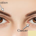 8 Things That Your Eyes Can Tell You About Your Health