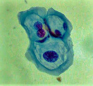 Células de prostata