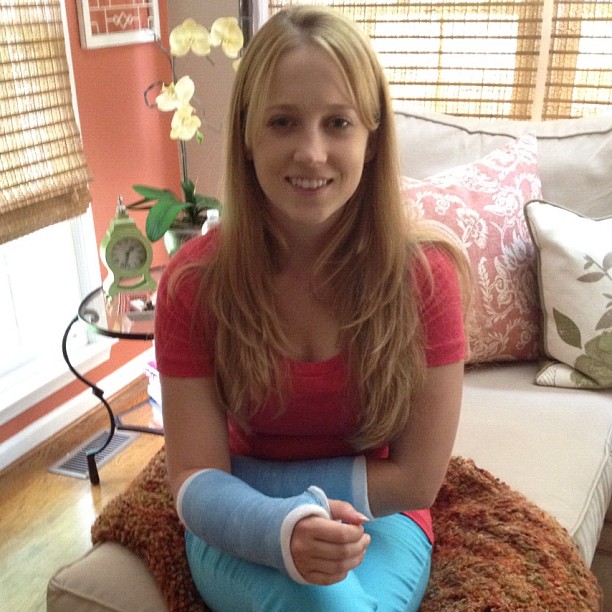 Cyber Arm Cast sexy arm cast