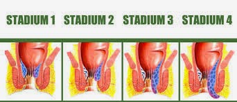 Stadium Ambeien Stadium Ambeien